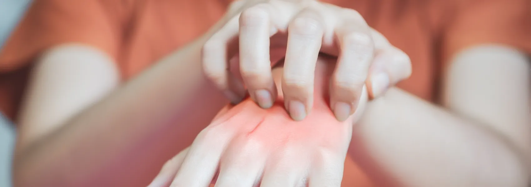 Разница между пищевой аллергией и атопическим дерматитом